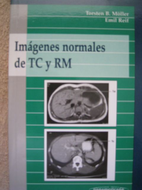 Imágenes normales de TC y RNM