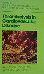 Thrombolysis in cardiovascular disease